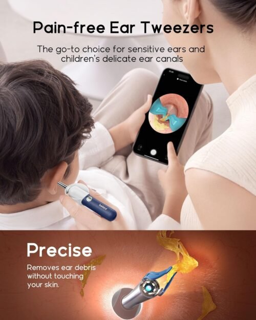 Bebird Earsight Plus R37R Ear Cleaning Camera Wax Removal Tool kit, Flexible Ear Scope Otoscope Camera Light, Visual Ear Picker Wireless Earwax Remover Tweezers for Adults & Kids - 이미지 4