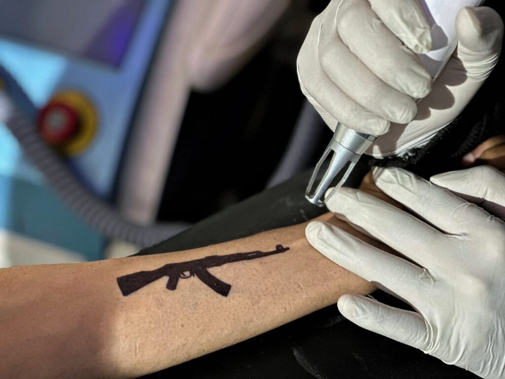 ‘Fear is real’: Why young Kashmiris are removing tattoos of guns, ‘freedom’ | India-Pakistan Tensions