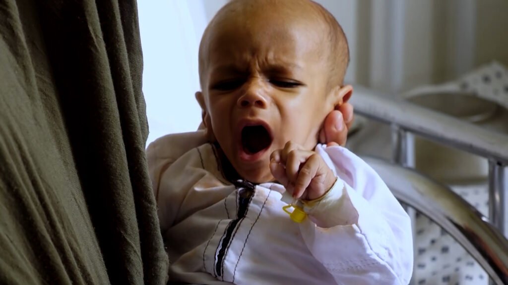 Afghanistan’s children starve as calls for help go unanswered