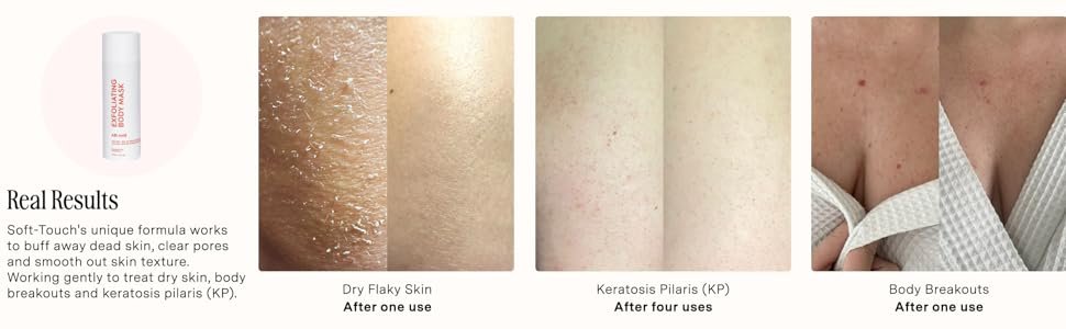 Glycolic & Salicylic Body Exfoliator - Pre-Shower Exfoliating Mask f 532